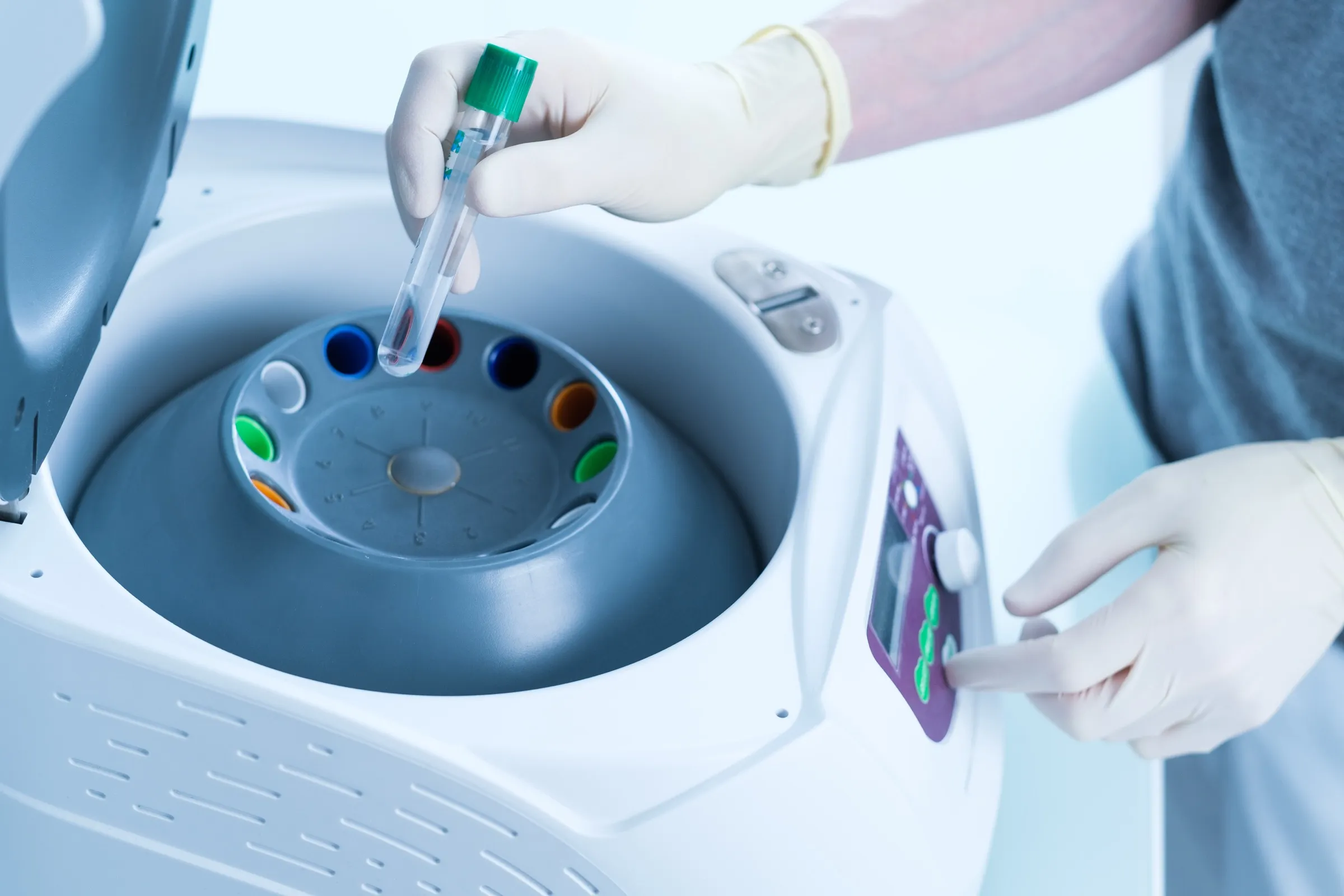 Zentrifuge mit Blutröhrchen zur Aufbereitung von Blutplasma