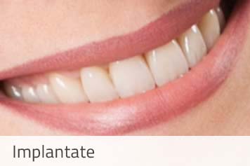 Implantologie
